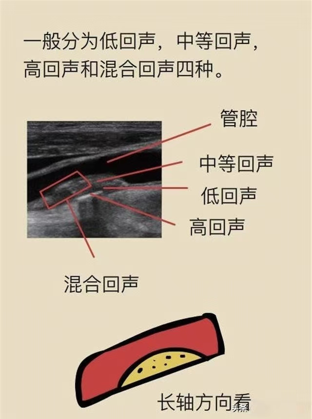 1735260622618028083.jpg 52e82708148277d791d321f6e2e7ef4.jpg