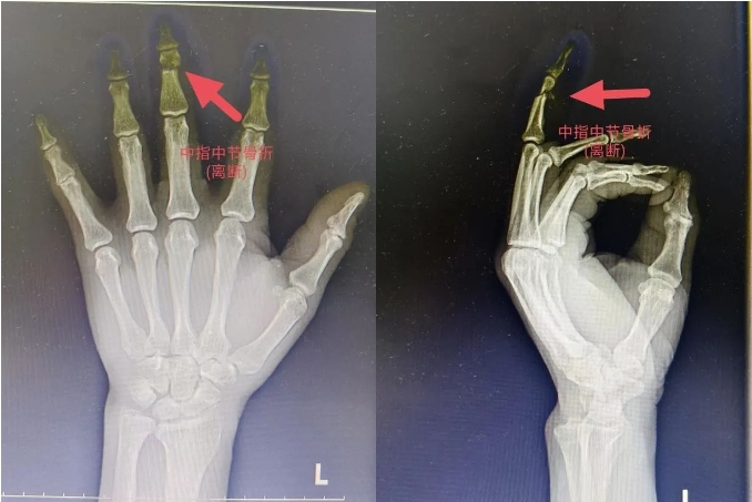 1737364371679095933.png 微信截图_20250120171319.png