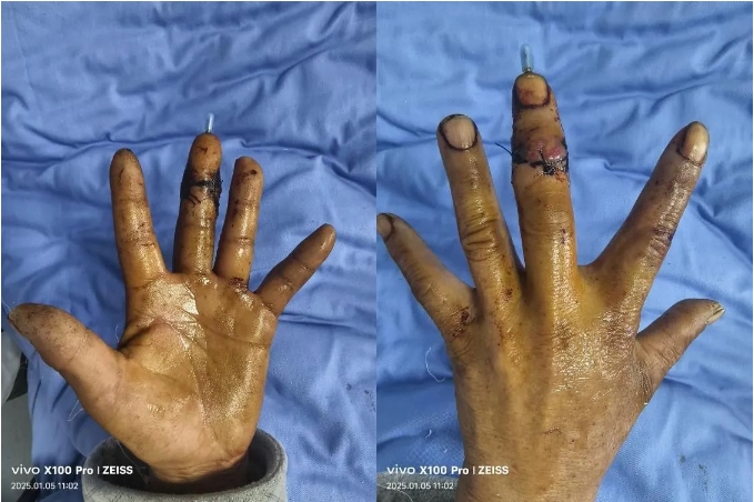 1737364499413085598.png 微信截图_20250120171334.png